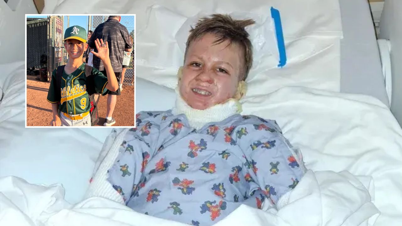 California Vacation Turns Horrific After Fire Pit Explodes, Leaving 8-Year-Old Boy Seriously Burned, Spends 19 Days in ICU