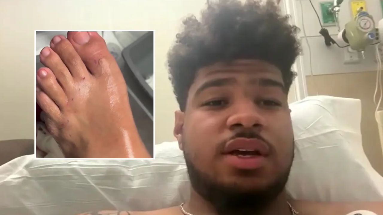 Dad-to-Be Suffers Brutal Shark Attack While Heroically Protecting His Pregnant Fiancée at Florida Beach