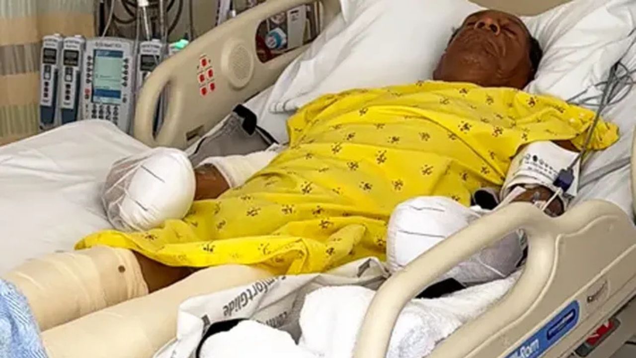 Family's Only Source of Income Destroyed After Car Plows Into 77-Year-Old Tamale Vendor Working With His Wife in Los Angeles, Man Hospitalized