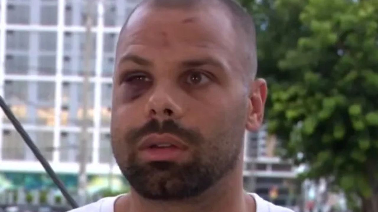 Florida Runner Says Man Ordered Two Pit Bulls to Attack Him During Evening Jog ‘I Just Want to Get Justice’