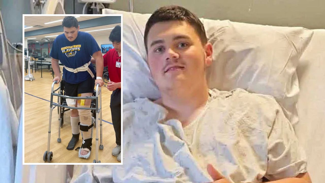 Teen Nearly Lost Both Legs in Horrific Farm Accident One Day After His 18th Birthday Now His Recovery Is Inspiring Doctors