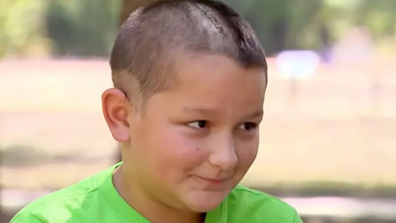 12-Year-Old Texas Boy Suffered Skull Fracture After Taking Off Helmet on E-Scooter, Mom Says