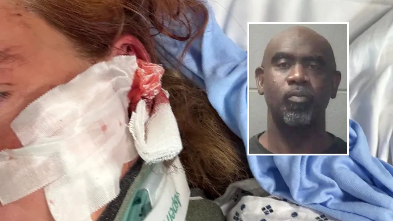 DoorDash Mom Attacked With Baseball Bat While Making Delivery, Suffers Skull Fractures and Brain Bleeds